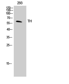 TH antibody