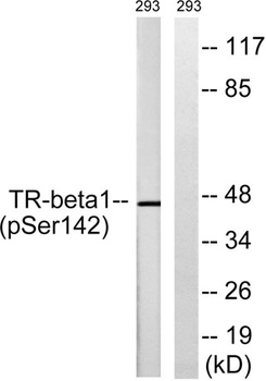 TR beta 1 (phospho-Ser142) antibody