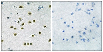 TIEG-1/2 antibody