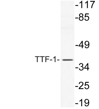 TTF-1 rabbit pAb