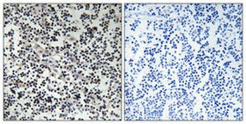 Thymidine Kinase antibody