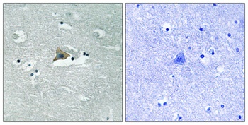 Claudin-5 (phospho-Tyr217) antibody