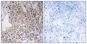 Tenascin-X antibody