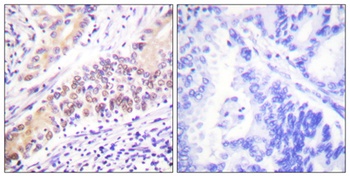 Topo II beta antibody