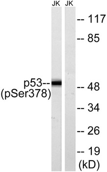 p53 (phospho Ser378) rabbit pAb Antibody