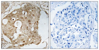 p53 (phospho Ser366) rabbit pAb Antibody