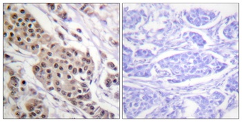 p53 (phospho Ser392) rabbit pAb Antibody
