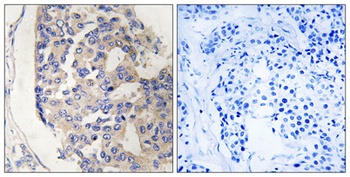 C1s rabbit pAb