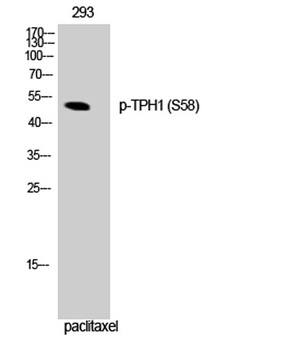 TPH1 (phospho Ser58) rabbit pAb