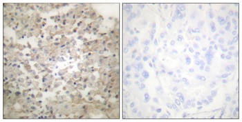 TPH1 (phospho Ser260) rabbit pAb