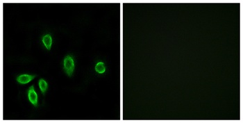 TRH-R1 antibody