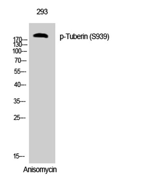 Tuberin (phospho-Ser939) antibody