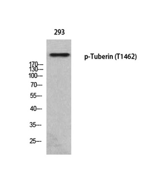 Tuberin (phospho-Thr1462) antibody