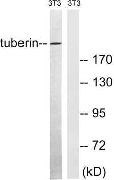 Tuberin antibody