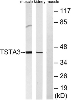 FX antibody