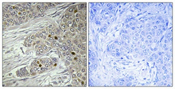 TTF-I antibody