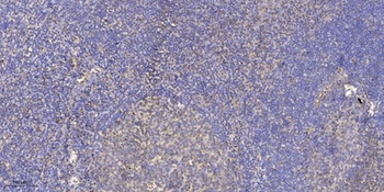 UBE2G1 antibody