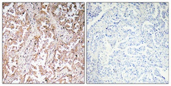 UCP2 rabbit pAb