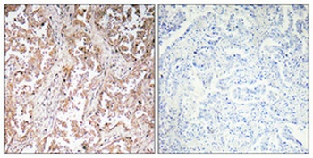 UCP2 antibody