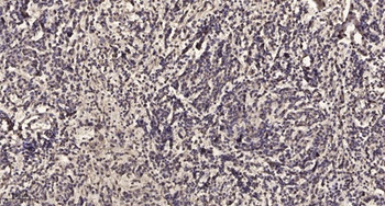VASP (phospho-Thr278) antibody