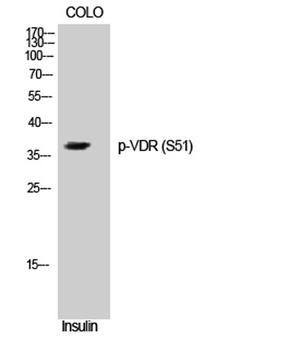 VDR (phospho Ser51) rabbit pAb