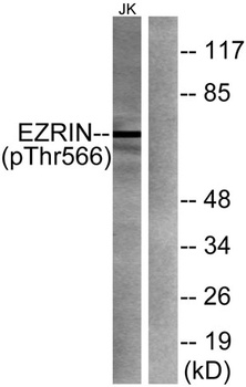 Ezrin (phospho Thr566) rabbit pAb Antibody