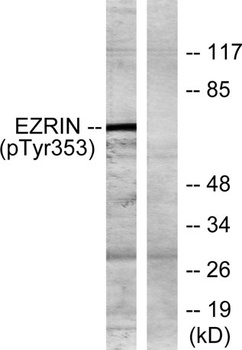 Ezrin (phospho Tyr353) rabbit pAb