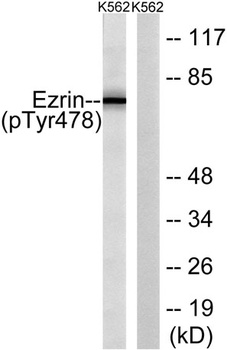 Ezrin (phospho-Tyr478) antibody