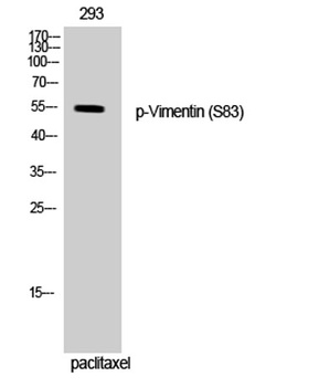 Vimentin (phospho-Ser83) antibody