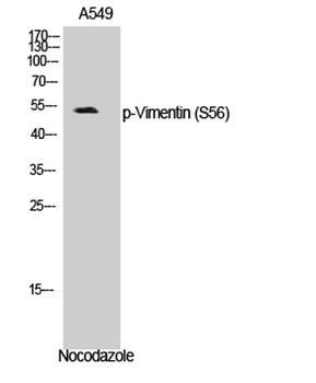 Vimentin (phospho Ser56) rabbit pAb