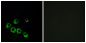 VPAC1 antibody