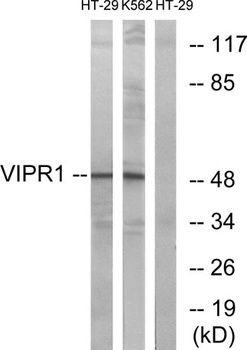 VPAC1 rabbit pAb Antibody