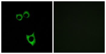 VPAC2 rabbit pAb