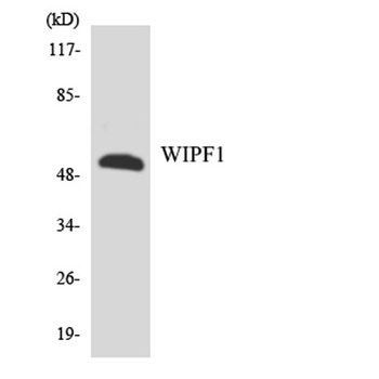 WIP antibody