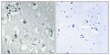 14-3-3 Eta antibody