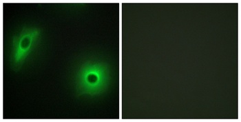 14-3-3 η rabbit pAb Antibody
