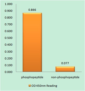 ZAP-70 (phospho-Tyr493) antibody