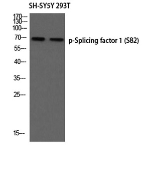 Splicing factor 1 (phospho Ser82) rabbit pAb