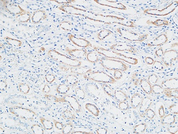 PBF antibody