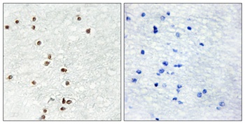 Zic1/2/3 antibody