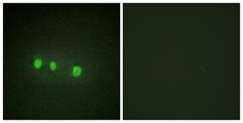 Zic1/2/3/4/5 antibody