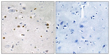 KOX4 rabbit pAb Antibody