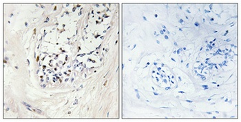 ZNF23 rabbit pAb