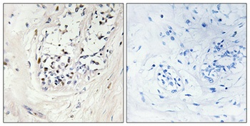 ZNF23 antibody