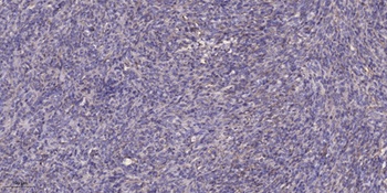 CA VIII rabbit pAb