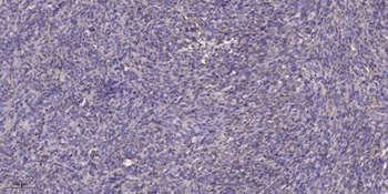 CA VIII antibody