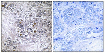 EFP antibody