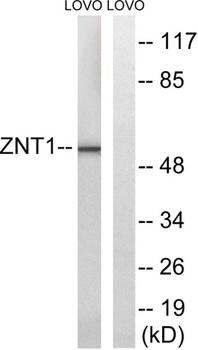 ZnT-1 antibody