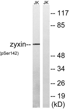 Zyxin (phospho-Ser142) antibody