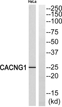L-type Ca++ CP γ1 rabbit pAb